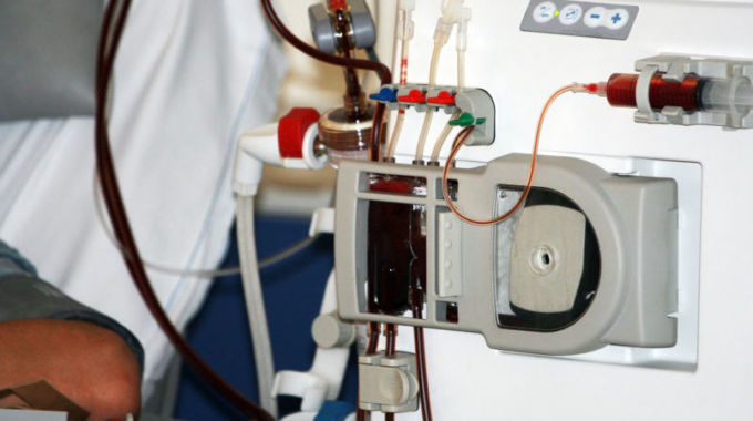 Young Man Hooked Up To A Dialysis Machine
